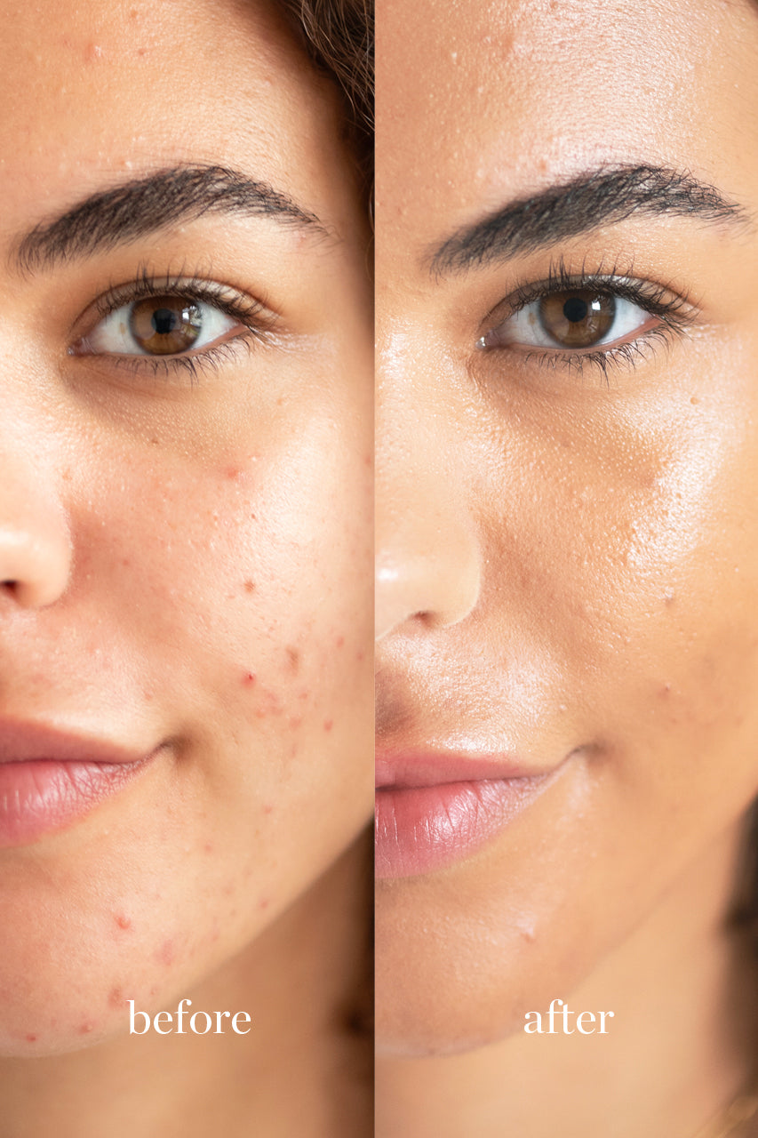 Lychee Créme Corrector