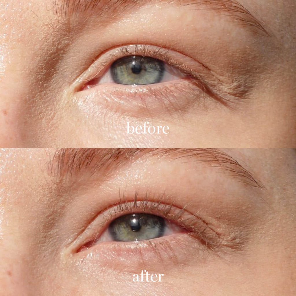 Spectacular Eyelash Curler