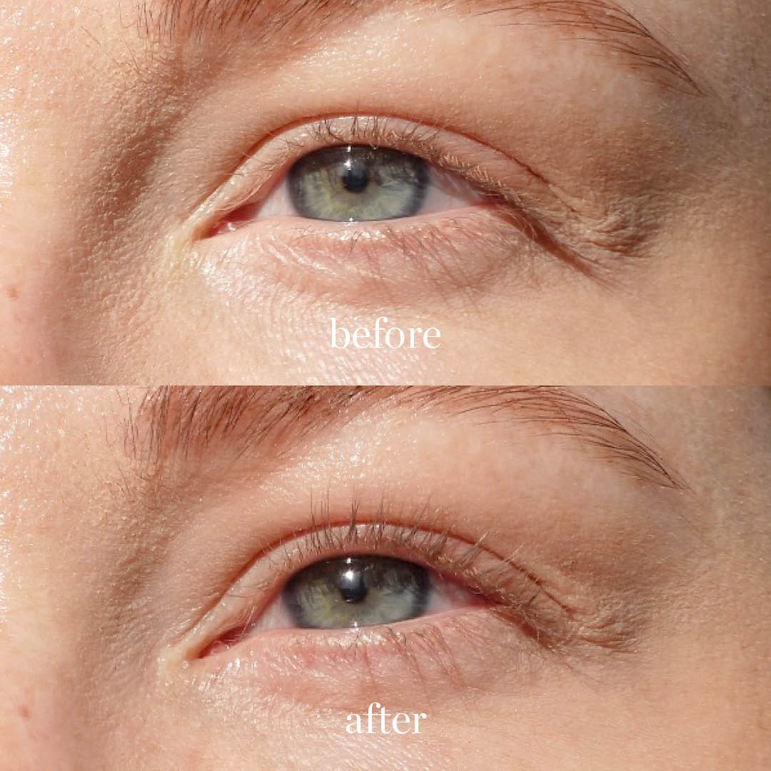 Spectacular Eyelash Curler