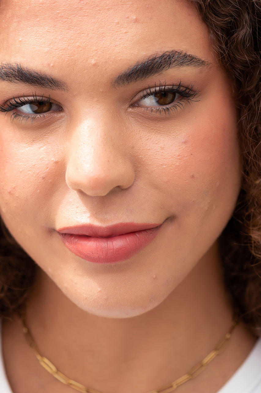 Arnica All-cover Pot